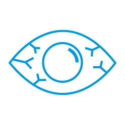 Glaukoma